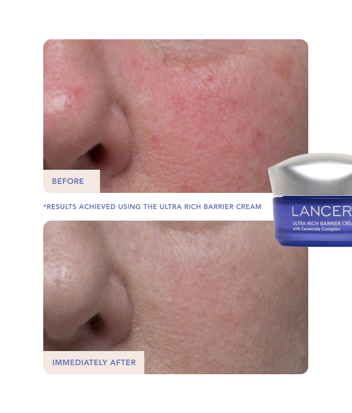 12 Days of Glow-Lancer Skincare