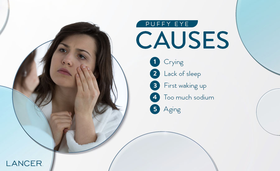 Puffy Eyes: Causes and How To Get Rid of Puffy Eyes