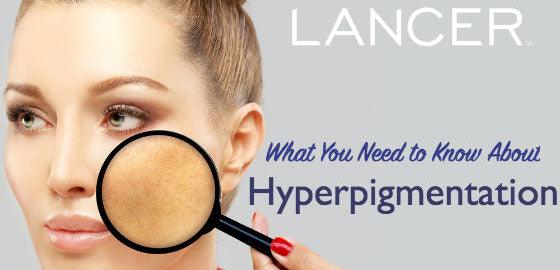 What You Need to Know about Hyperpigmentation - Lancer Skincare