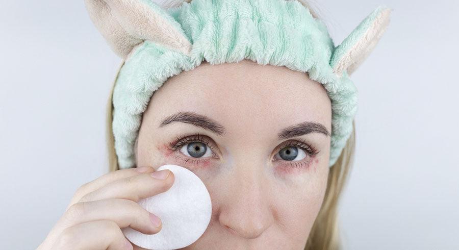 Allergy to cosmetics. The girl looks at the pimples around her eyes that appeared after using toxic cosmetics. Red spots on woman skin