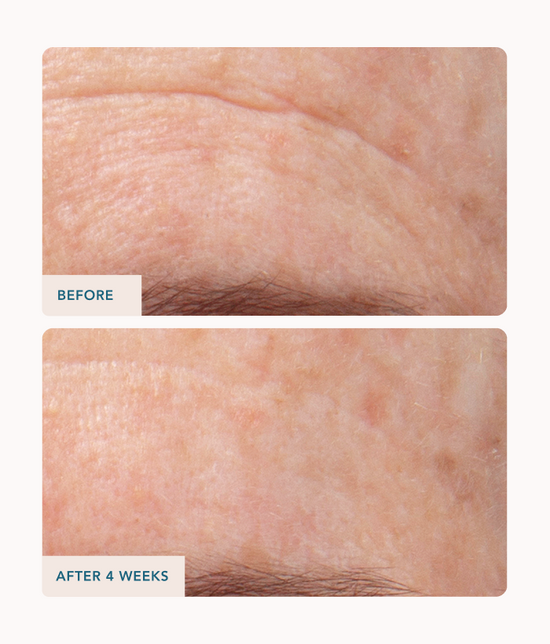 The Method Intro Kit | Normal-Combination Starter Set | Lancer Skincare