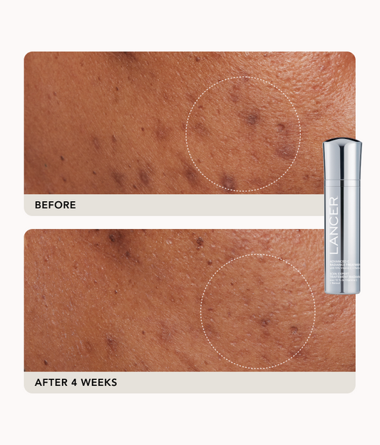 Advanced Treatment Duo