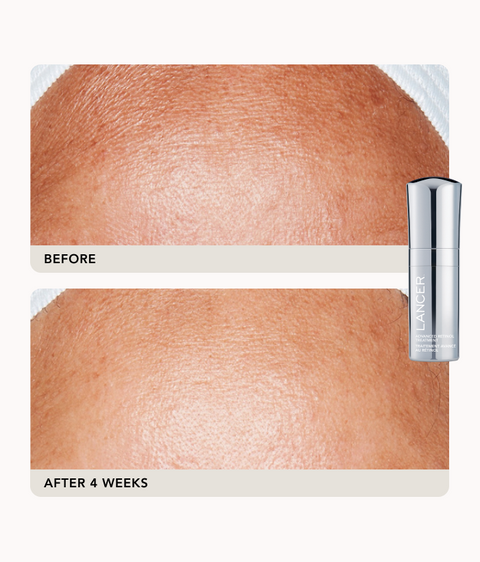 Advanced Treatment Duo