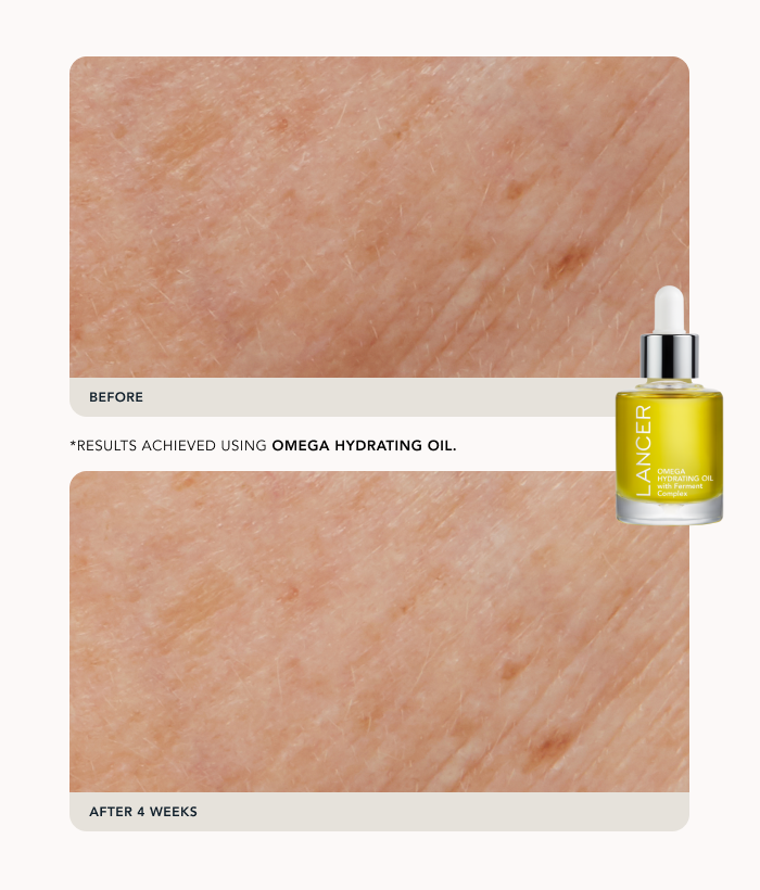 Holiday Weekender Kit-Lancer Skincare