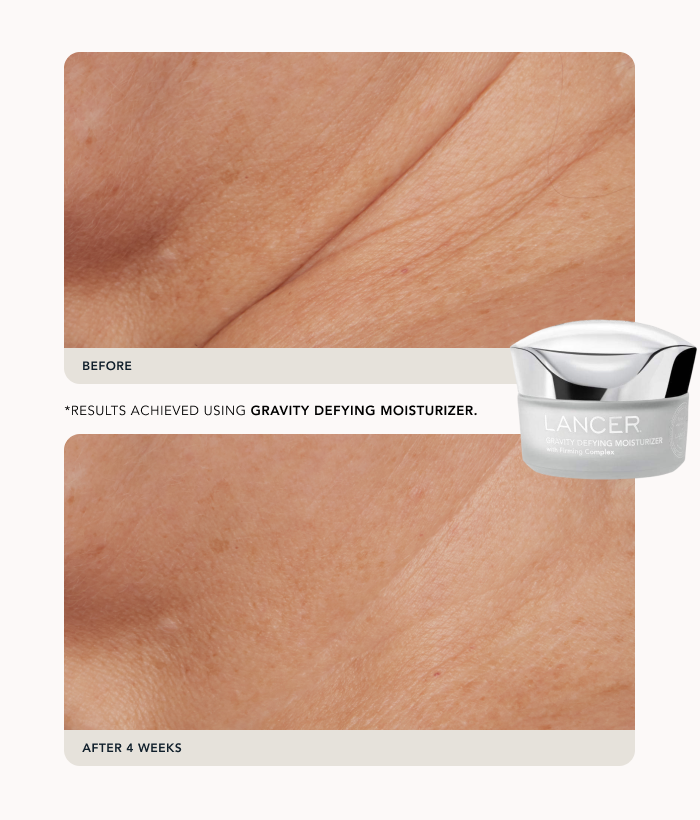 Holiday Weekender Kit-Lancer Skincare