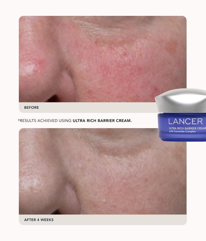 Peptide Barrier Duo