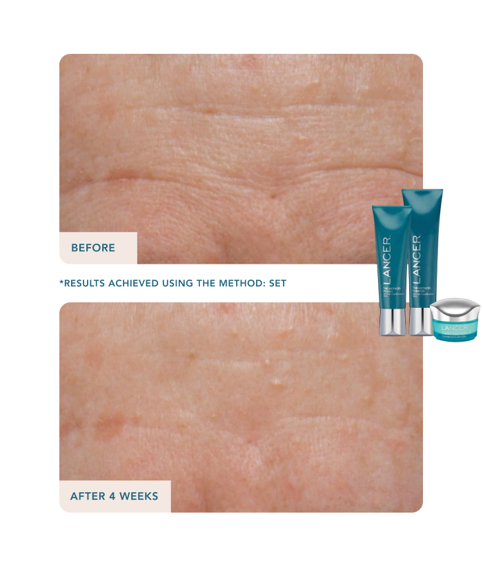 12 Days of Glow-Lancer Skincare