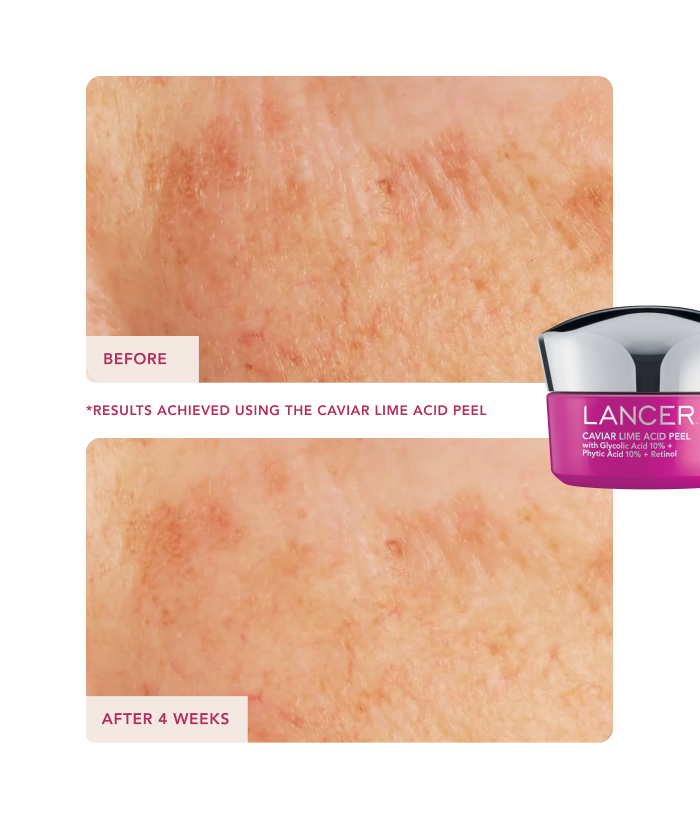 12 Days of Glow-Lancer Skincare