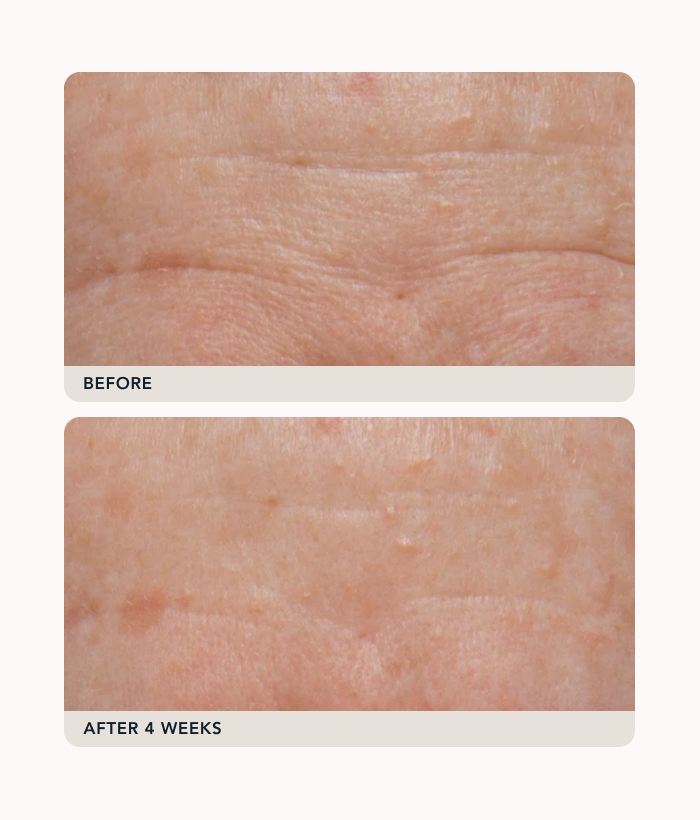 The Method: Glow To Go Ornament-Lancer Skincare