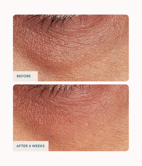 Eye Contour Lifting Cream