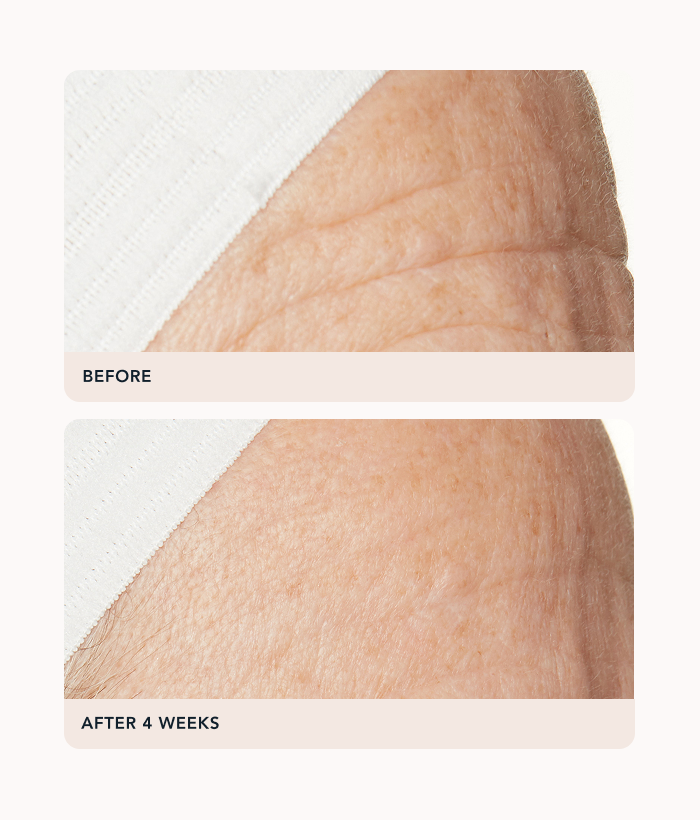 Before and after comparison of skin texture on a white background-Lancer Skincare