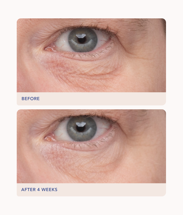 Before and after comparison of a person's eye with visible wrinkles, labeled 'Before' and 'After 4 Weeks'.-Lancer Skincare