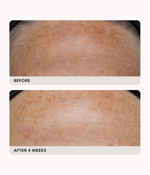 Gravity Dark Spot Correcting Serum
