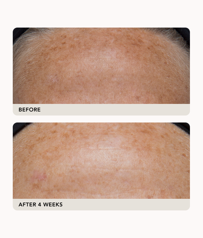 Gravity Dark Spot Correcting Serum