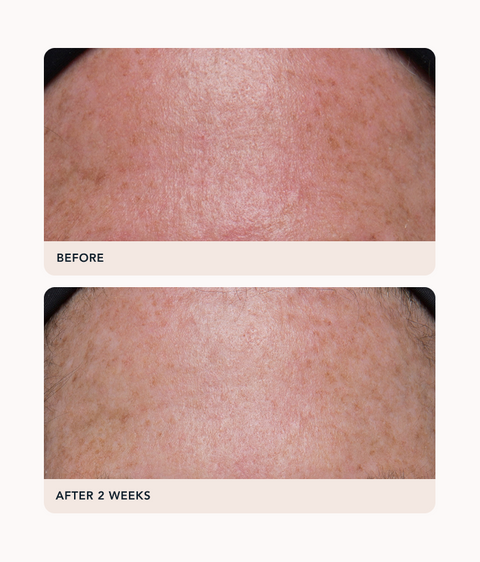 Gravity Dark Spot Correcting Serum