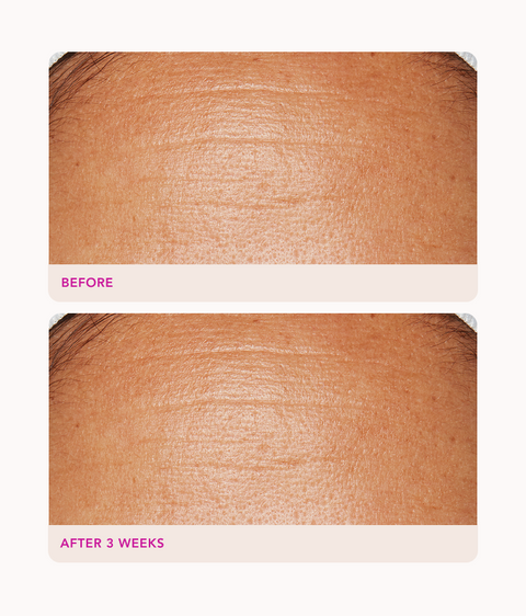 Gentle Exfoliating Peel Pads