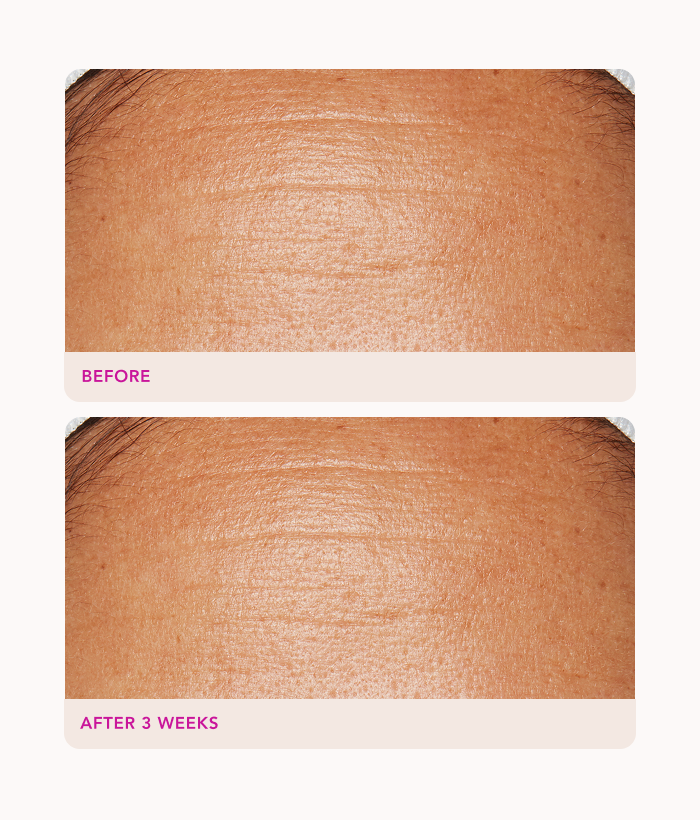 Gentle Exfoliating Peel Pads