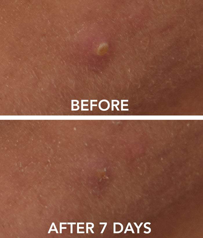 Clarifying Spot Solution-Lancer Skincare