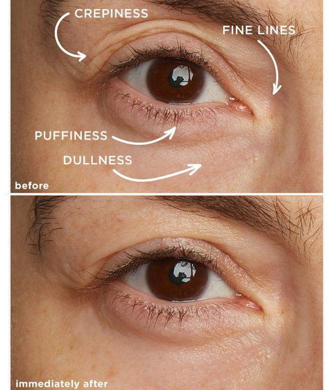 Eye Contour Lifting Cream