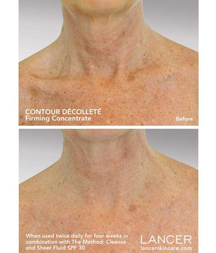 Contour Decollete - Neck & Chest Cream | Lancer Skincare
